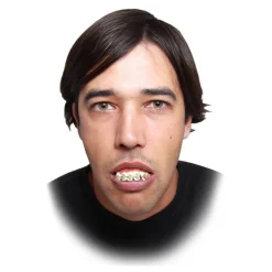 Dentadura con Brakets